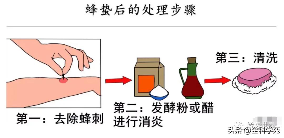 烧伤烫伤防护与急救知识英文,烧伤冻伤如何处理