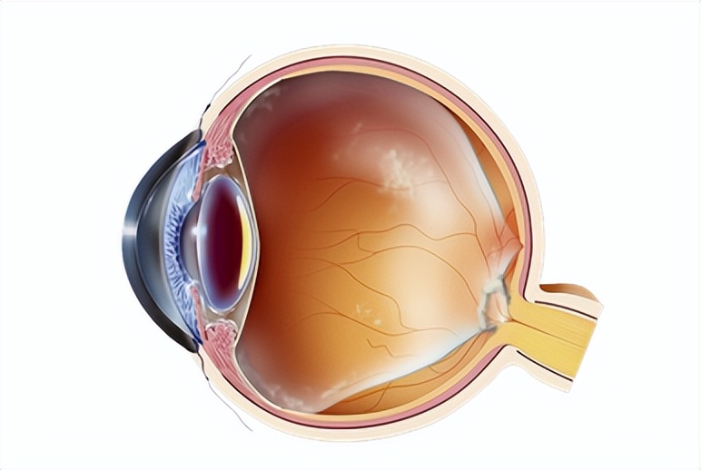 感觉眼前有东西飘过怎么回事,眼前老是有东西在飘动