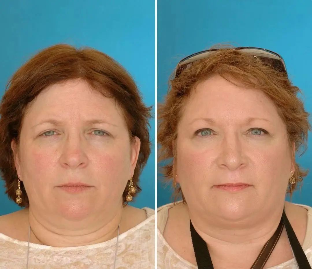 气血不足老得快教你一招延缓衰老,促进血液循环的代茶饮