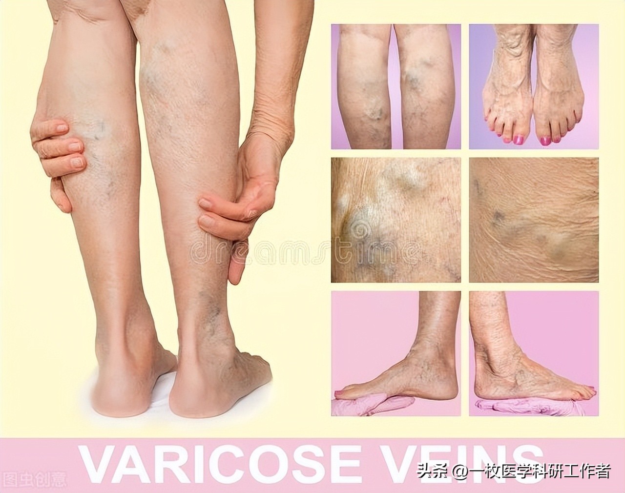 经常跷二郎腿的后果是什么,为什么翘二郎腿腹部会疼