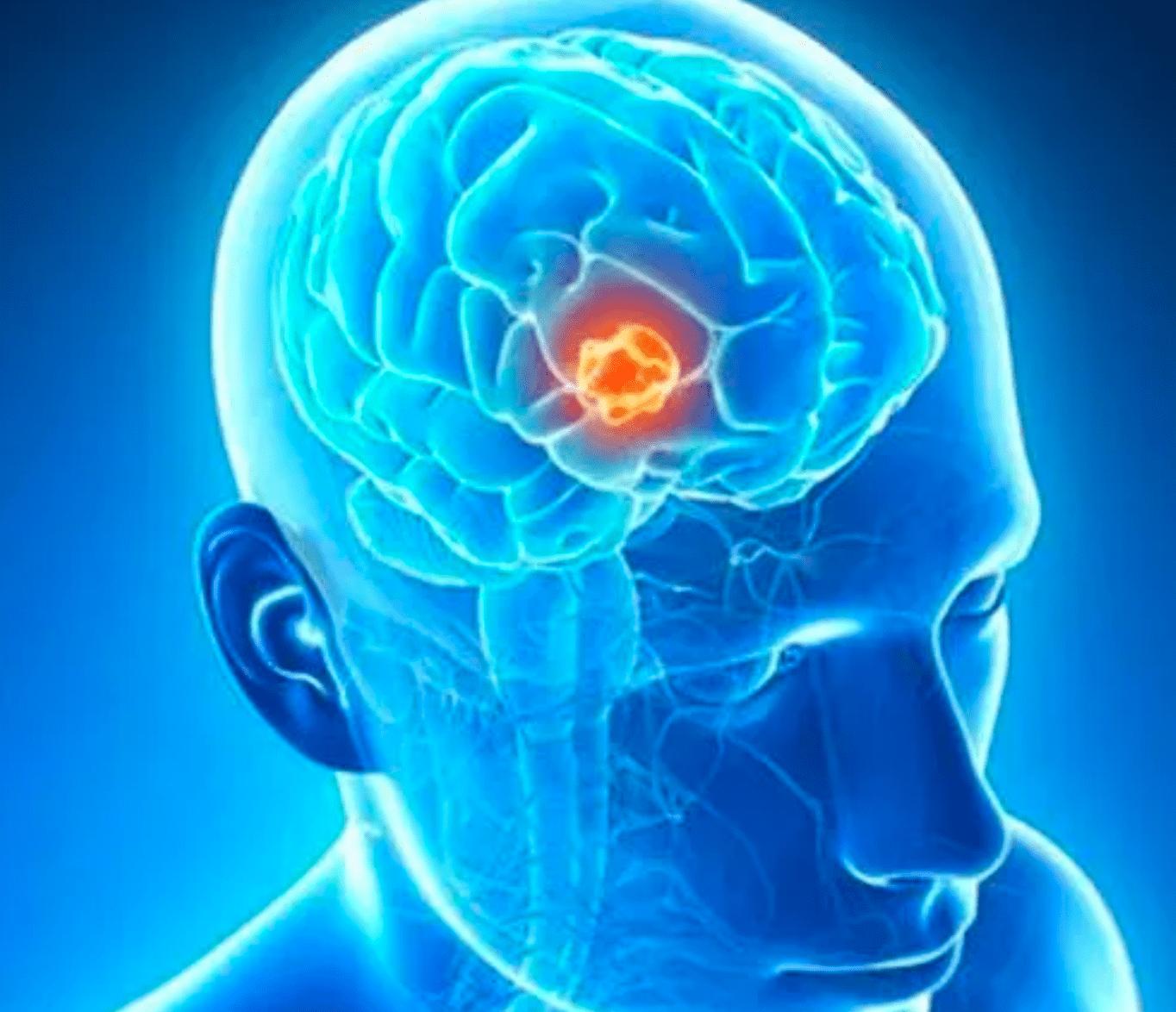 肝癌小细胞癌的治疗方法,肝癌的诊断和治疗方法简答题