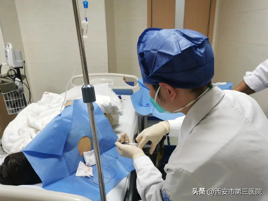 低颅压性头痛应怎样治疗,低颅压性头痛是怎么治疗