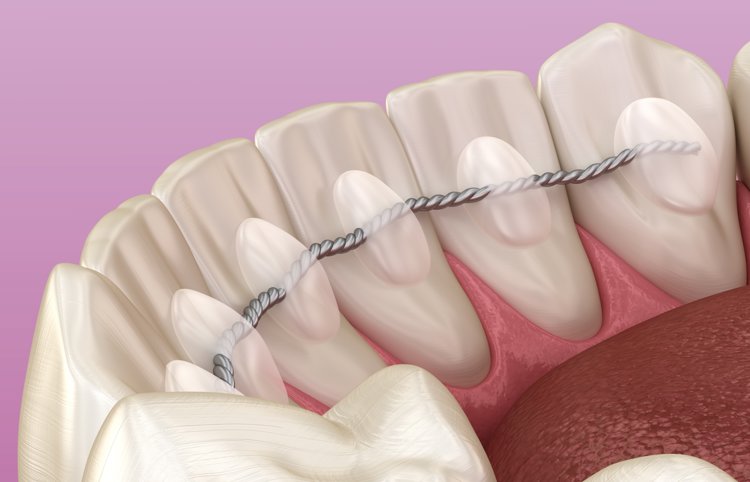 老人掉牙有什么办法阻止吗,怎样防止老人牙齿松动掉牙