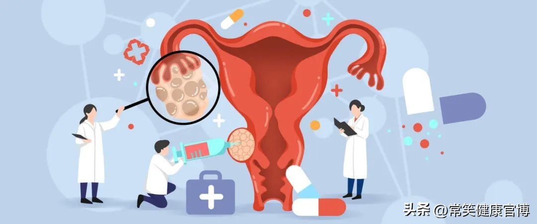 不要低估这些小细节！轻松预防子宫脱垂