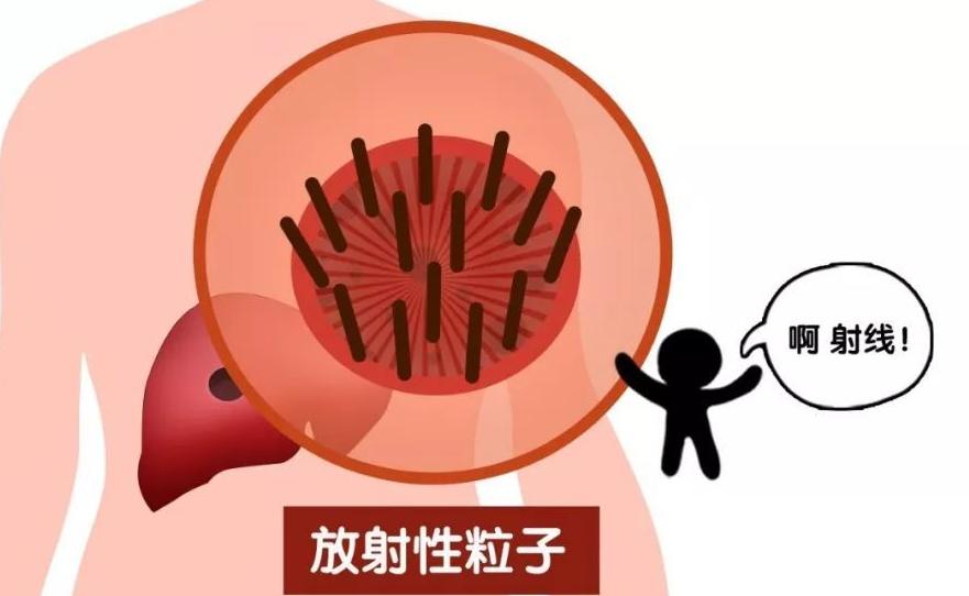 精准微创介入治疗肿瘤效果怎么样,哪些属于微创介入治疗