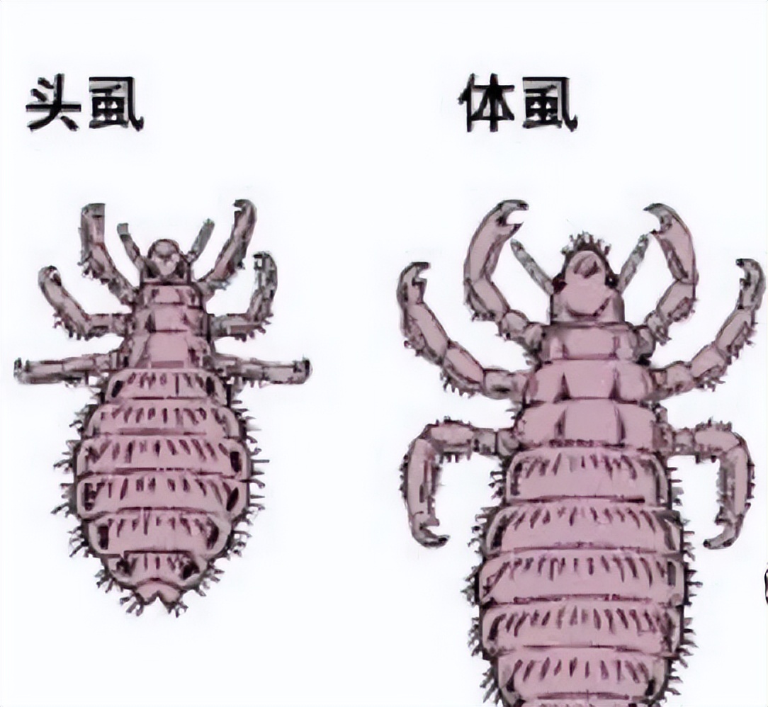 曾经无孔不入的虱子是怎么来的？为何如今很少看到了？