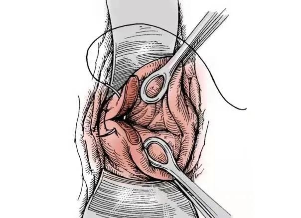白带变多,生完小孩为什么白带是绿色的