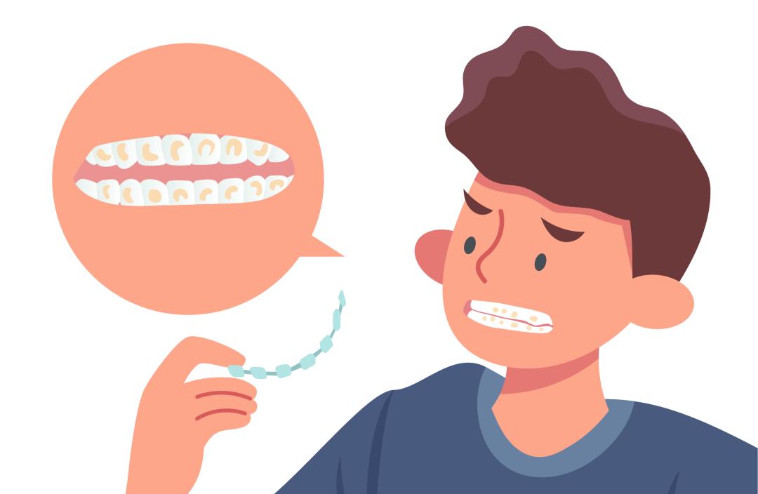 牙齿矫正后变黄怎么变白,牙齿矫正后牙齿变黄怎么回事