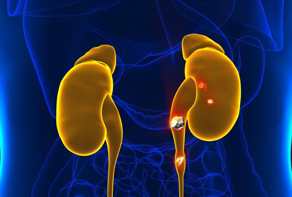 尿里有血怎么治疗,尿液中有隐血是怎么了