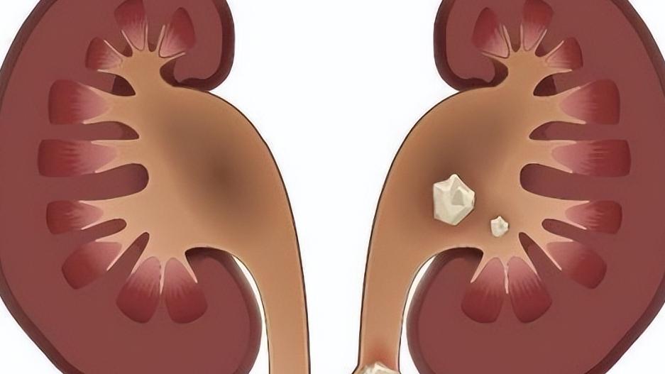 晚上喝牛奶的危害牙齿,晚上喝牛奶的十大禁忌