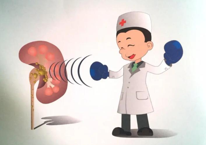 肾结石的自白书：我是肾结石，这是我兴风作浪的一生