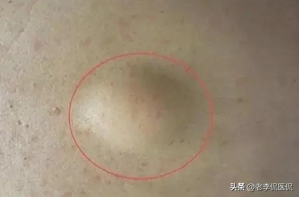 肾气足百病除,肾气足百病除下一句