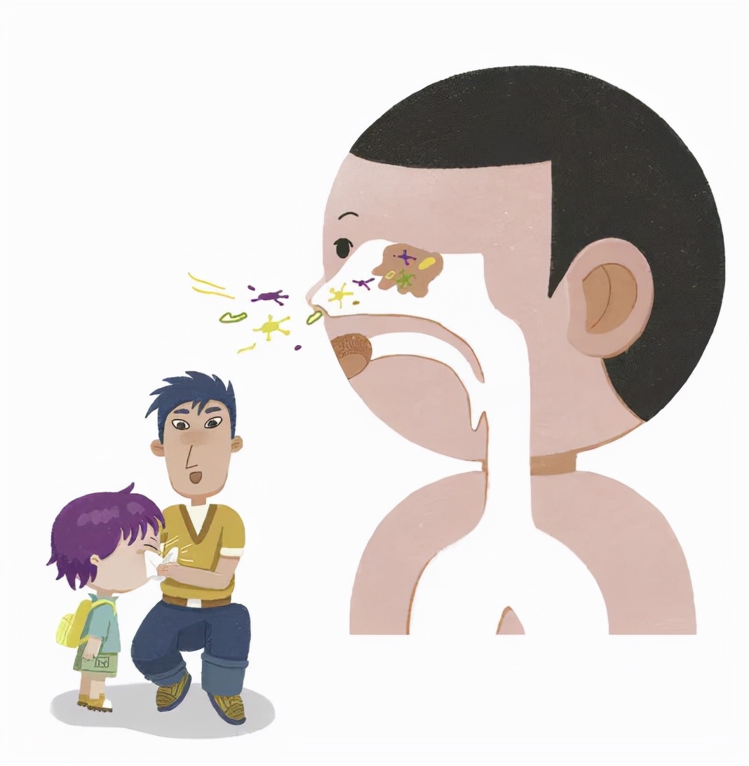 儿童反复流鼻涕鼻出血鼻塞打喷嚏,流鼻血流鼻涕打喷嚏怎么回事