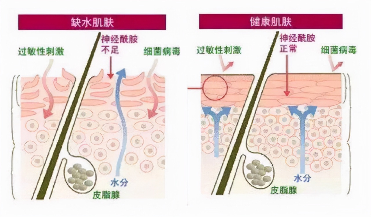 敷面膜补水了脸还是起干皮,敷面膜先补水还是敷完后补水