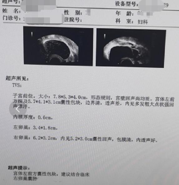 卵巢囊肿别害怕,卵巢囊肿不是小事