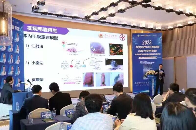 脱发移植手术,毛发克隆治疗脱发