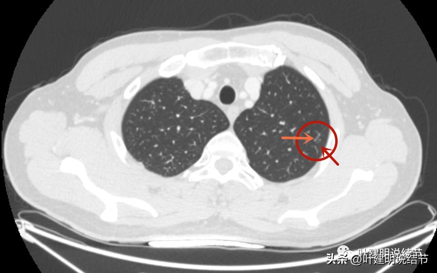 医生为了预防医患矛盾过度诊疗,医院过度医疗手术