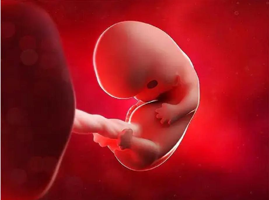 印度女子产下罕见胎中胎,胎中胎真实案例印度