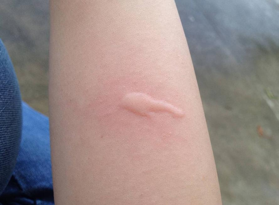 教你一招消灭家里所有的蚊子,对付蚊子的30个妙招