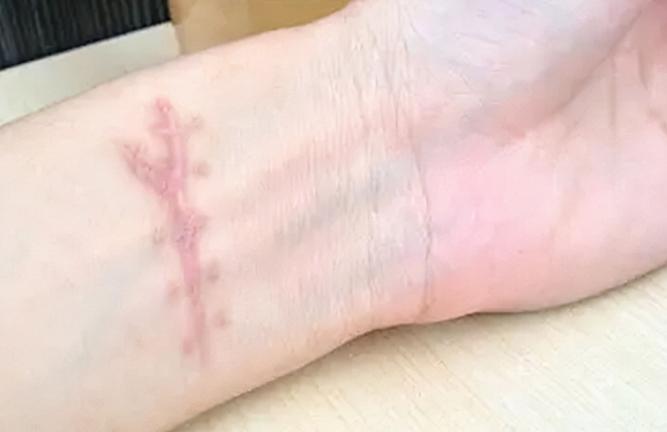 21岁小伙桥边崩溃欲跳江,四川16岁男孩跳桥被女孩救了