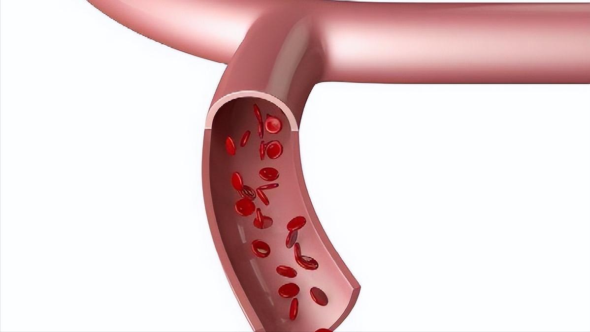 因为太年轻患高血压焦虑怎么缓解,高血压人紧张烦躁怎么办