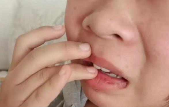 陕西中学老师殴打11岁学生,陕西3名殴打中学生人员已被控制