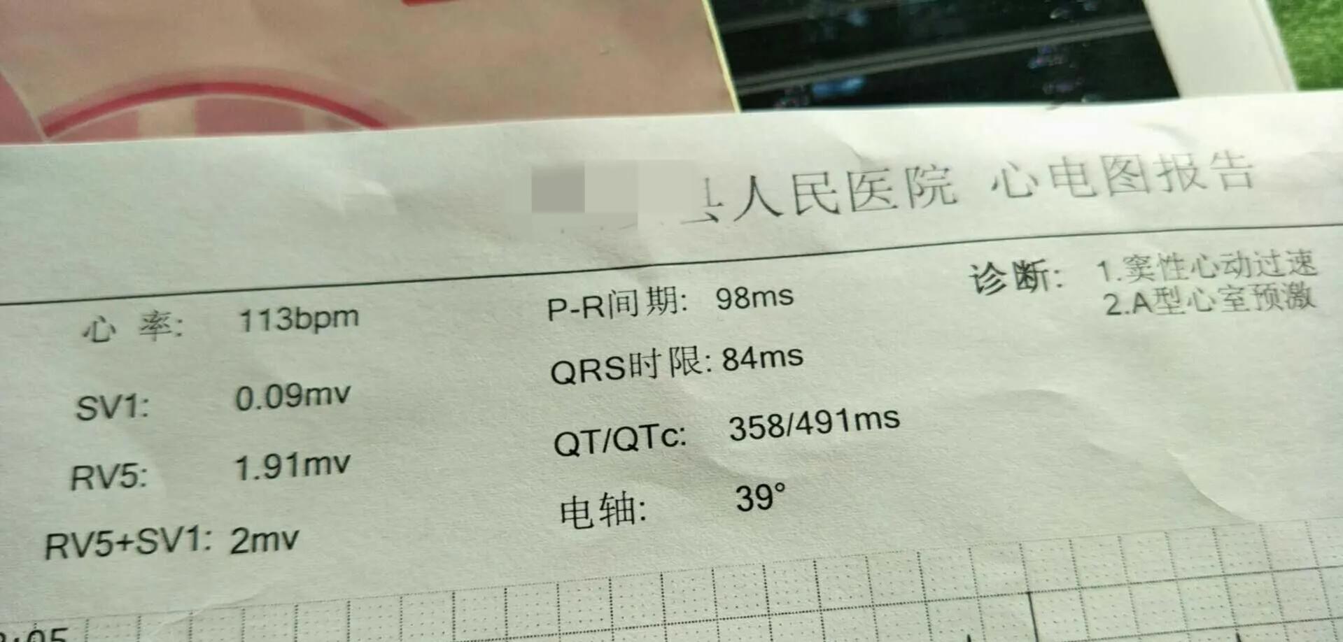 美托洛尔用于心脏病功效,美托洛尔治疗心脏使用方法