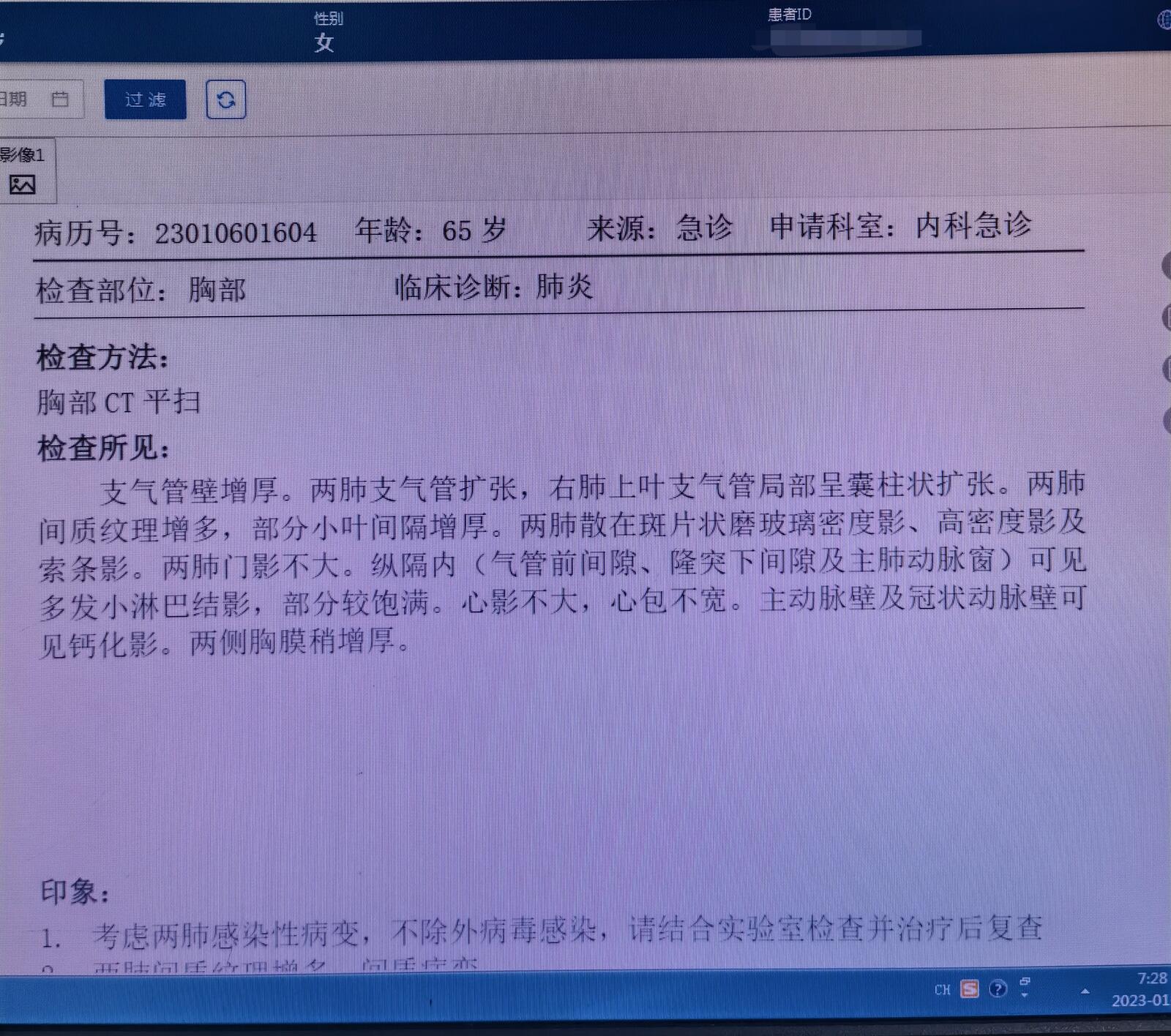刘懿说肺癌排查结核,刘懿博士说肺癌的症状