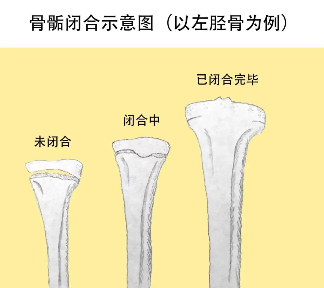 十岁女孩怎么才能长更高,怎样才能长更高