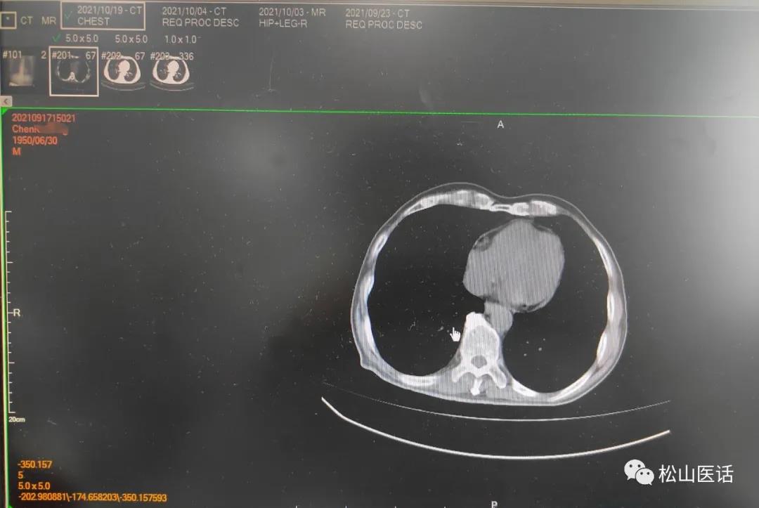 松山医话最新消息,松山医话系列之血液