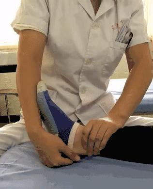 足内翻容易崴脚,足内翻多走路锻炼能减轻吗