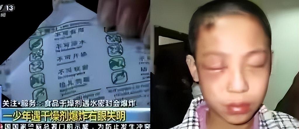 7岁男孩眼球被炸后融化,七岁男童眼睛秒被溶化