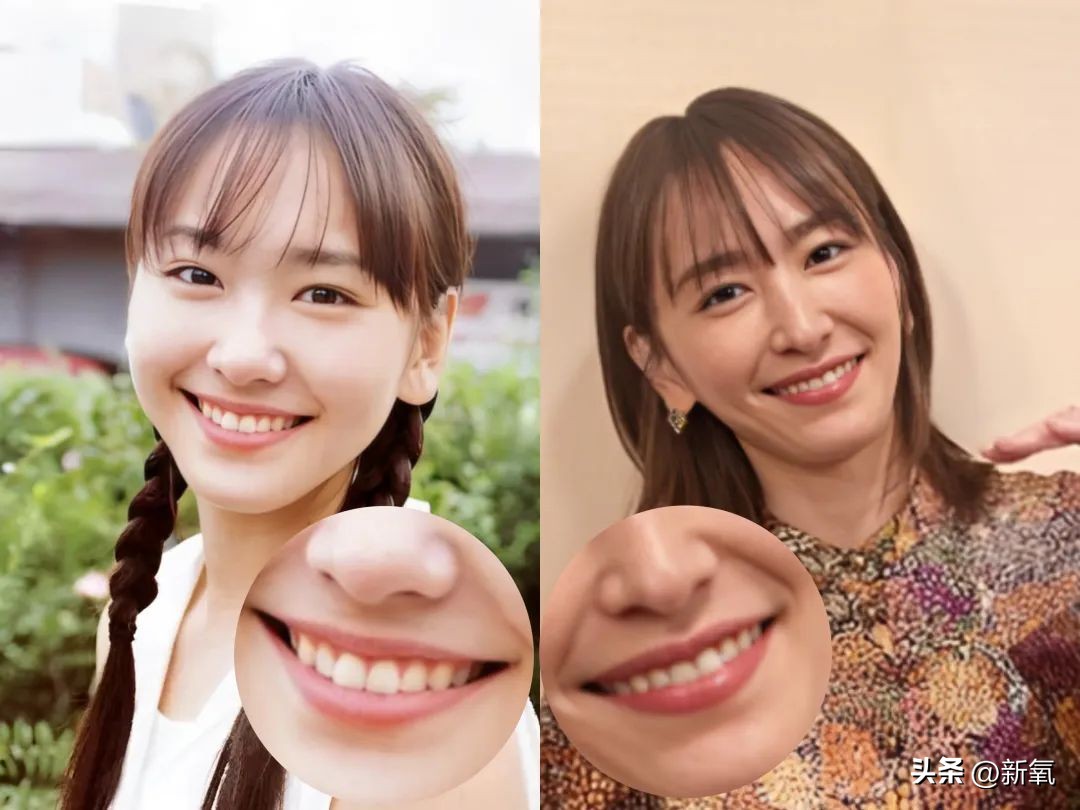 牙齿正畸和骨骼正畸的区别,牙齿正畸和眼轴增长有关系吗