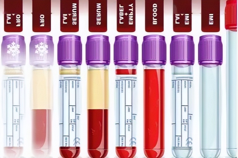 每年体检查血应该查哪些方面,体检生化免疫检查结果什么意思