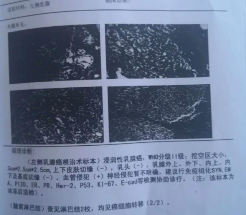 妻子患癌丈夫拒绝治疗完整版,妻子查出癌症晚期丈夫不愿给看