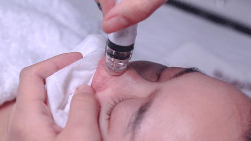 美容院高端项目表,高端大气的美容院项目名字大全