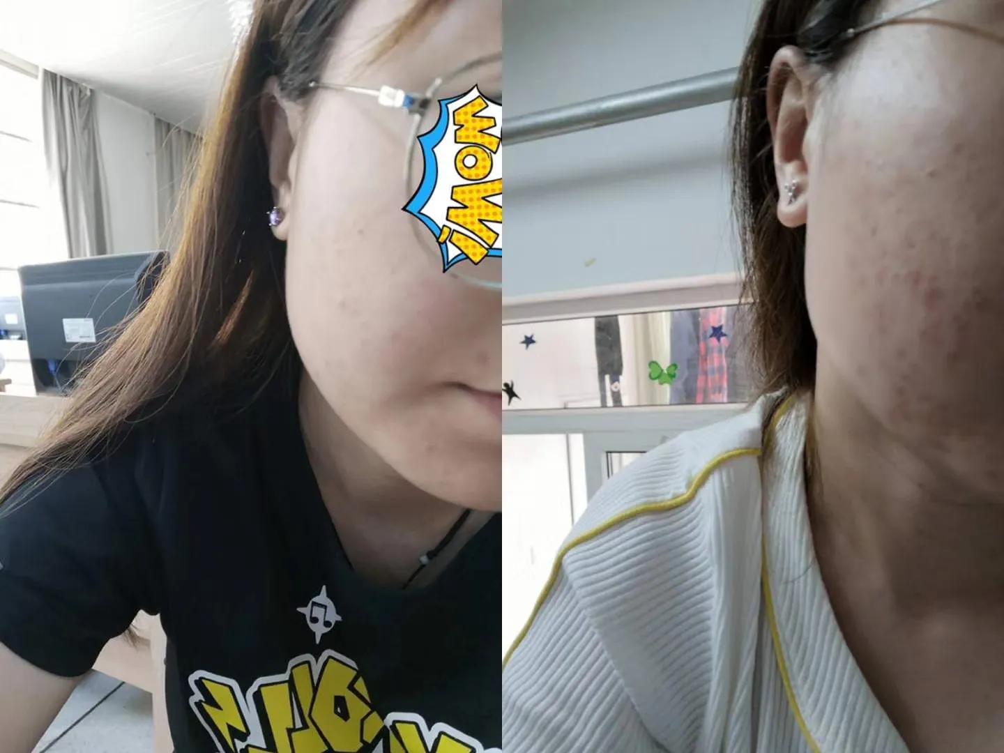 疮痈中医辨证论治,治疮疡的方子