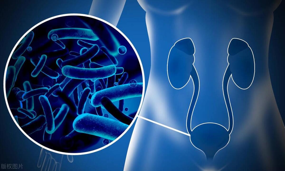 避免膀胱炎,避免急性膀胱炎最好的治疗方法