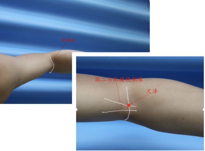谷医堂保健品,谷医堂扶阳罐