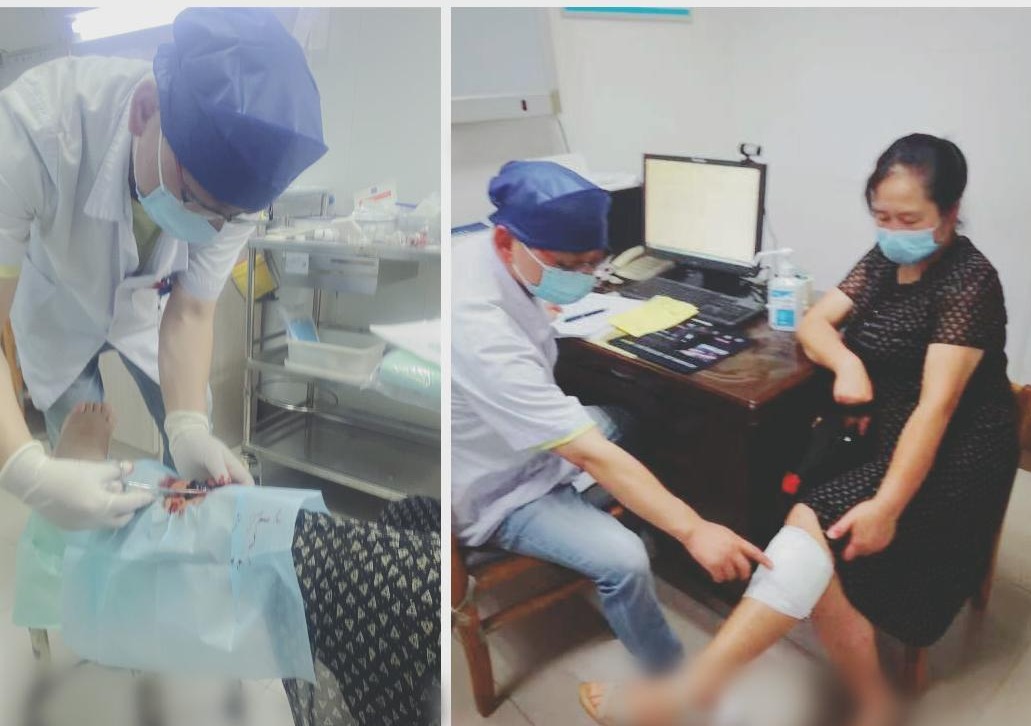 摔了一跤身上有个小硬块一直不好,摔了一跤后手臂肉里长了一个疙瘩