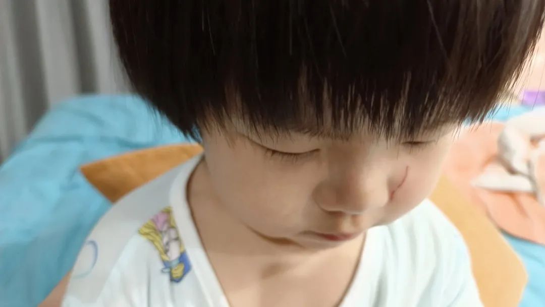 小孩在家生病常备什么药,孩子生病必备小药