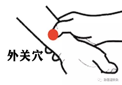 三焦不通扎针灸可以治愈吗,针灸打通三焦的绝密方法