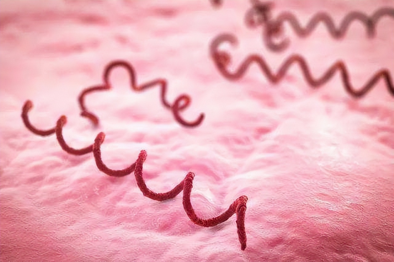 梅毒初期是什么症状梅毒怎么治,得了梅毒会有什么症状