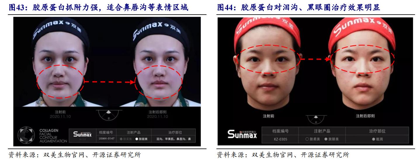 鑳跺師铔嬬櫧鍥藉唴宸蹭笂甯傜殑鍏,鑳跺師铔嬬櫧鑳藉惁鎴愪负璺ㄨ秺鍛ㄦ湡鍘熸枡