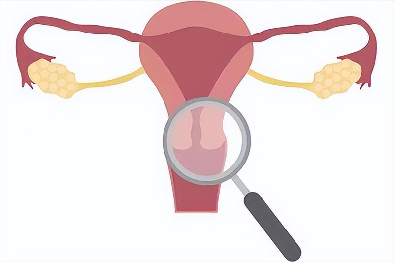 乳腺癌服用他莫昔芬失眠,三阴乳腺癌能服用他莫昔芬吗