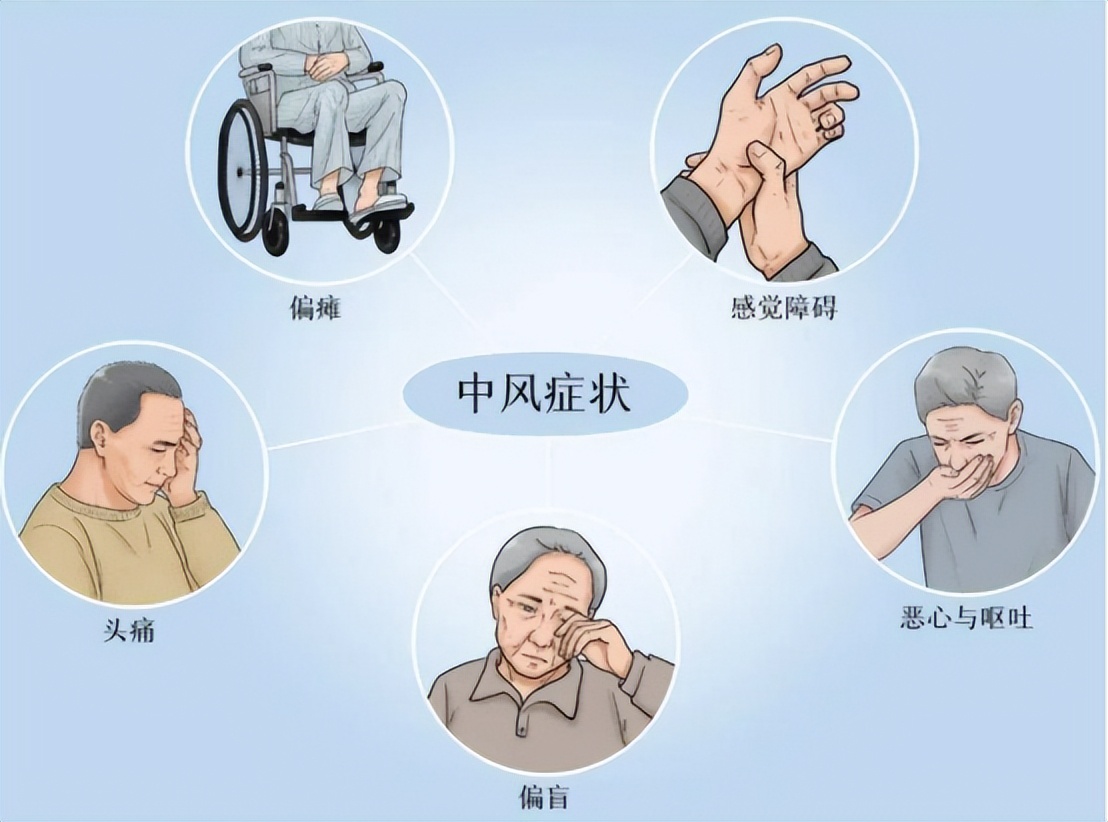 缺血性脑卒中中医治疗原则,急性缺血性脑卒中诊治指南最新版