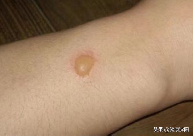 健康知识中医讲座,中医健康知识讲座小视频