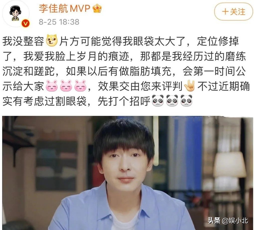 鼻梁修没了,眼泪都看不到,女演员的“专属滤镜”还能再假点吗?