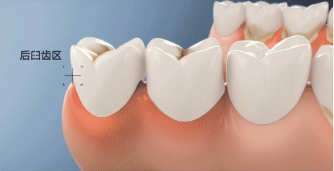 评测推荐的电动牙刷儿童,测评几款儿童u型电动牙刷视频