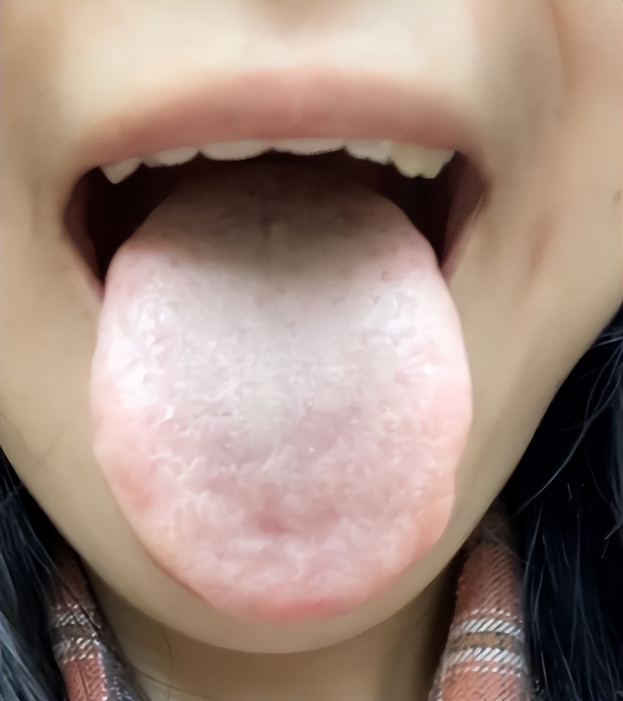 夜尿频多畏寒怕冷吃什么药好,夜尿多腰膝酸软多梦吃什么药